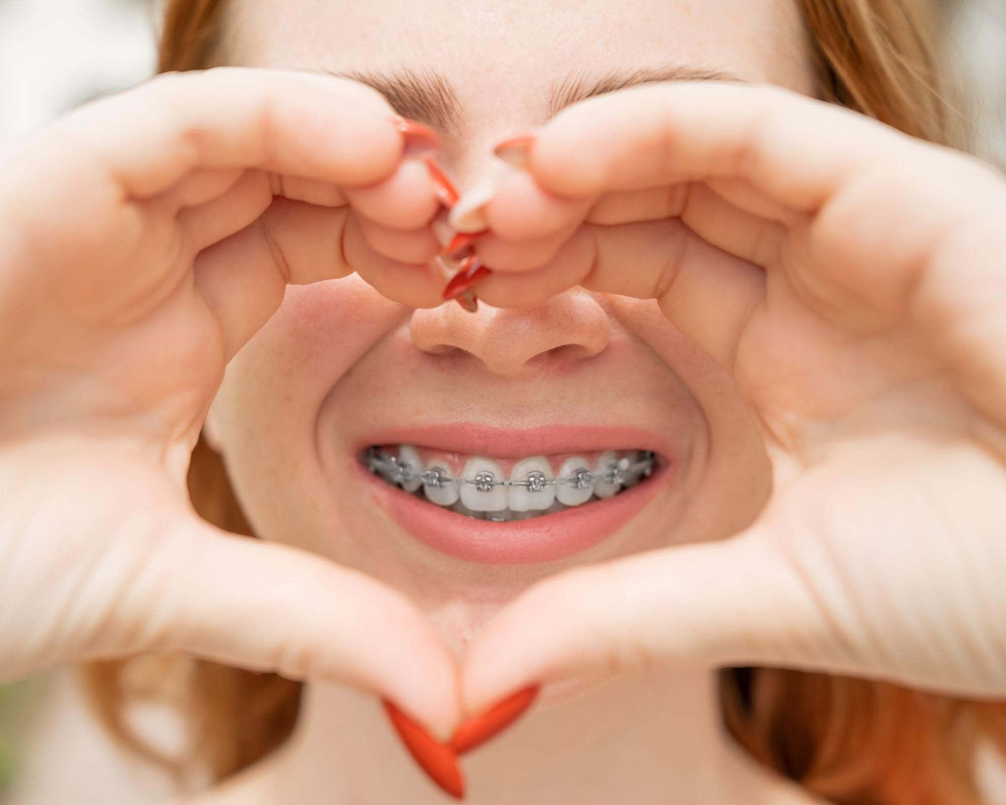 Young woman with braces making a heart shape with her hands, smiling brightly, representing positive orthodontic experiences at White Orthodontics in Eagle Mountain.