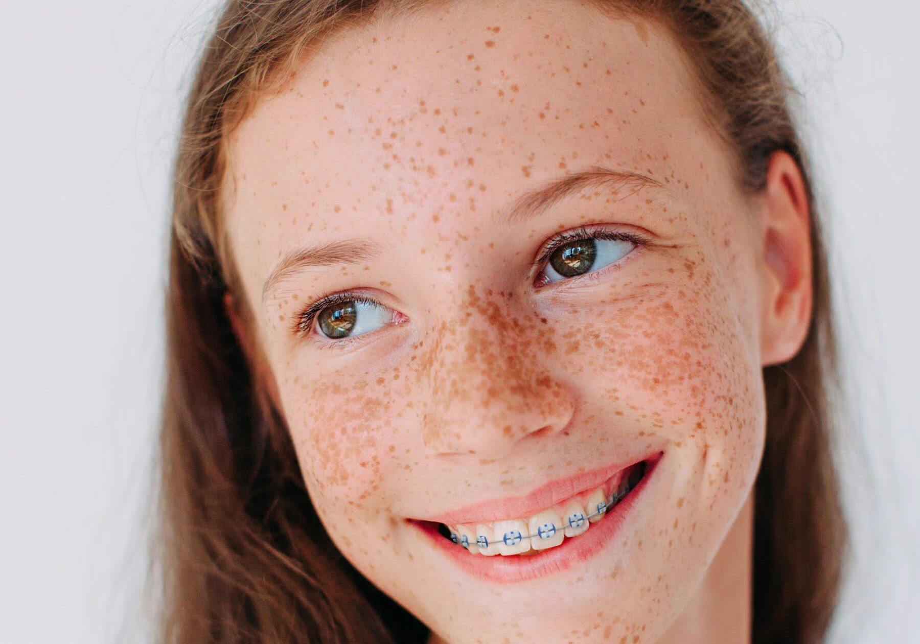 braces eagle mountain